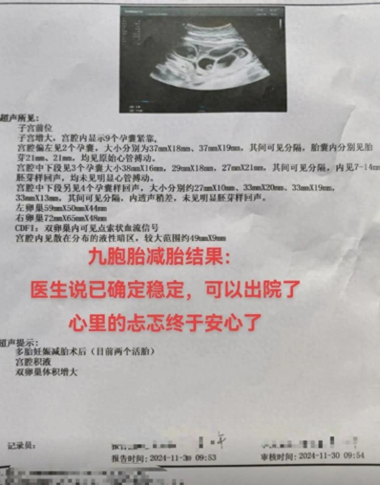 江西南昌25岁女子怀9胞胎引热议，减胎手术后情况稳定已出院